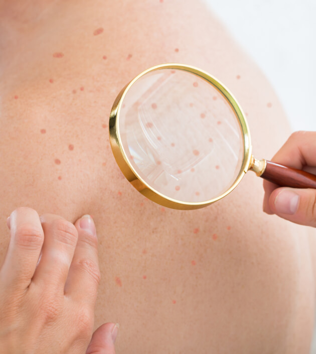 Your Comprehensive Guide to Hill Country Acne Center Consultation Options
